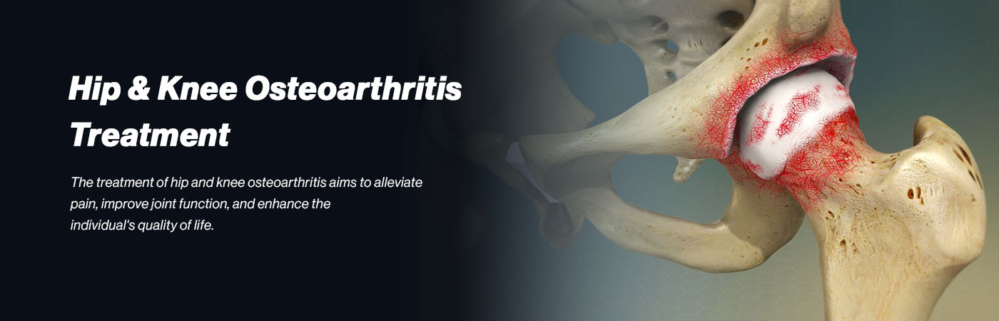 hip-knee-osteoarthritis
