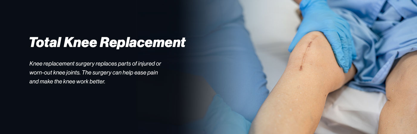 knee-replacement